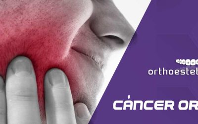 Cáncer oral